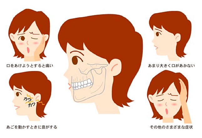症 顎 治療 関節 【2021年】和歌山県の顎関節症治療の歯医者さん♪おすすめしたい7医院